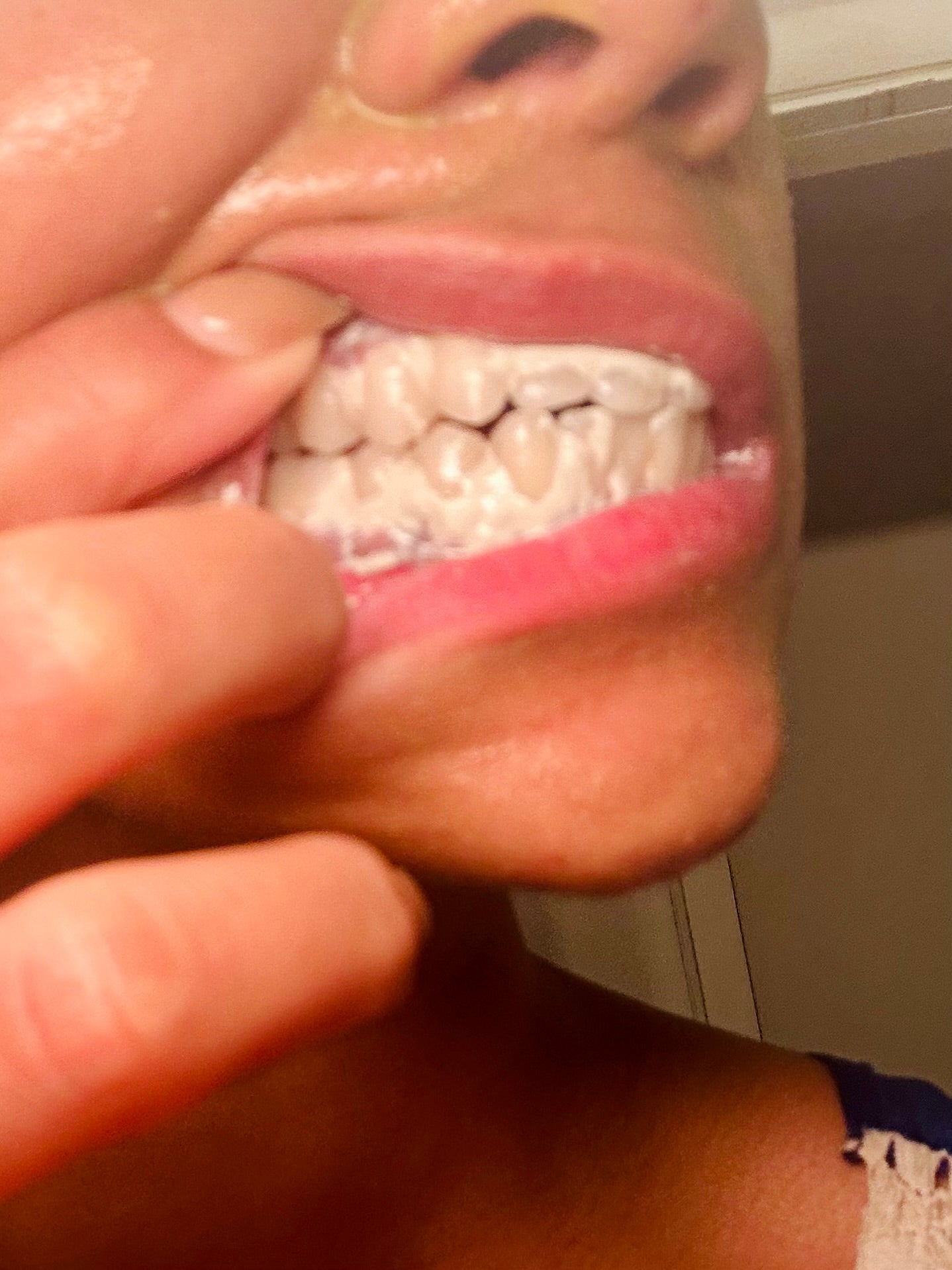 Gum Guard - Mineralizing Therapy Paste