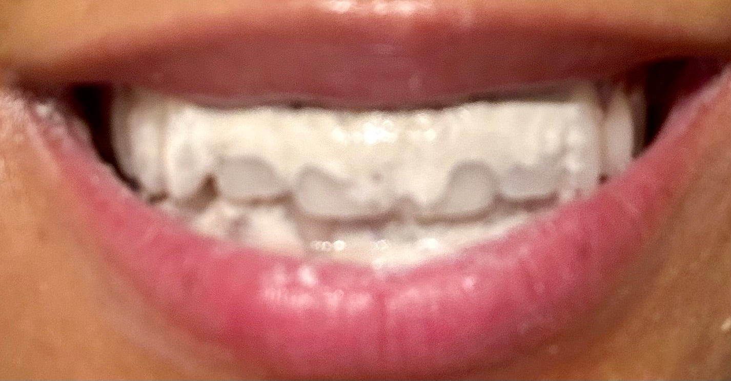 Gum Guard - Mineralizing Therapy Paste